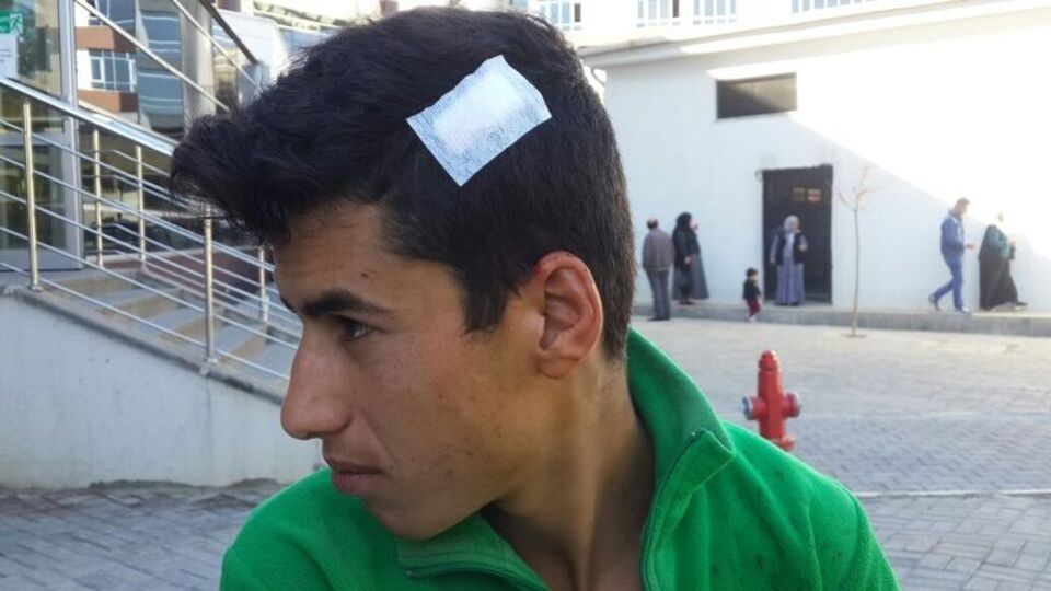 Suriyeli çocuğun kafasında fayans kırıldı!