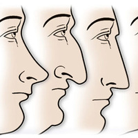 Burun şeklinden karakter analizi