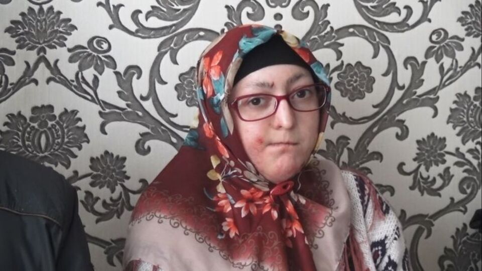 Kelebek hastaları yardım bekliyor