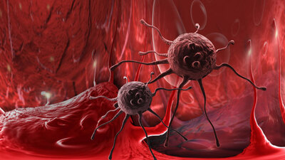 20'den fazla kanser türüne neden oluyor!