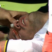 Van Persie hastanelik oldu