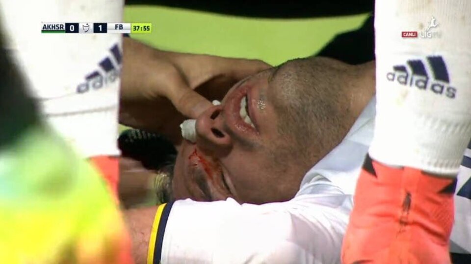 Van Persie hastanelik oldu