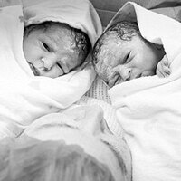 Dünyada bir benzeri daha yok! Hamileyken hamile kaldı