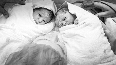 Dünyada bir benzeri daha yok! Hamileyken hamile kaldı