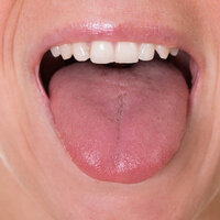 Dilinize dikkatli bakın! Eğer bunlar varsa...