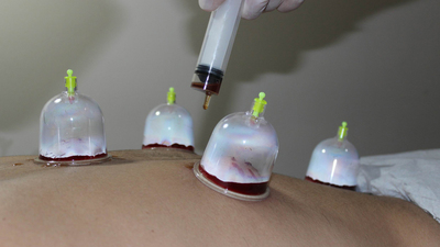 Kaçak hacamata 10 ay hapis!