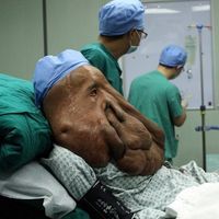 Milyonda bir görülüyor!