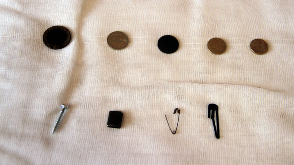 Yuttukları cisimleri "hatıra" olarak saklıyorlar!