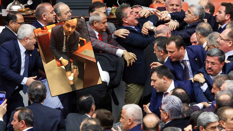 Ak Partili vekili kim ısırdı?