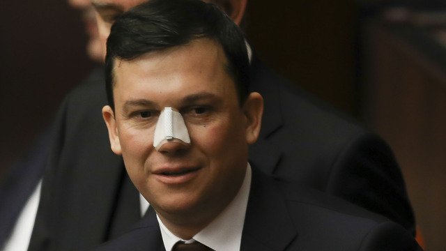 Burnu kırılan vekilden suç duyurusu