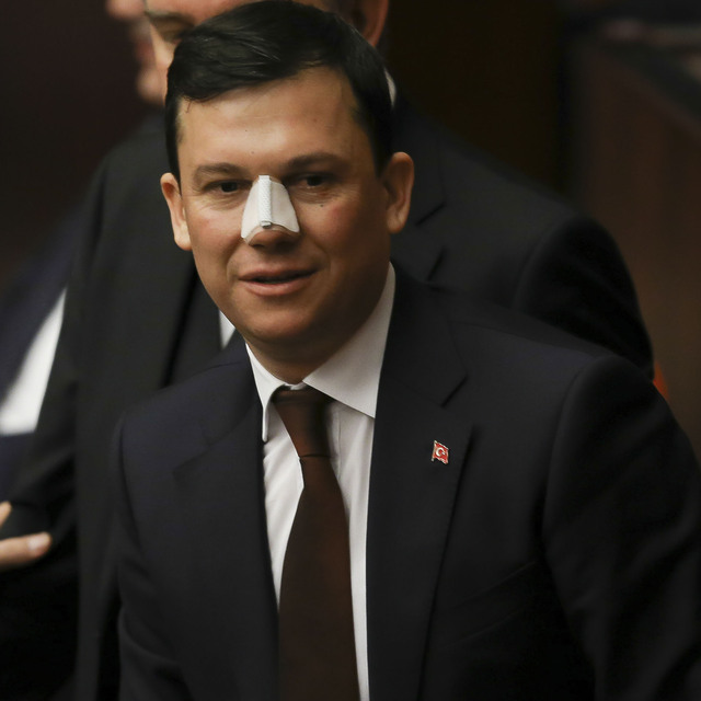 Burnu kırılan vekilden suç duyurusu