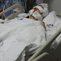 Burun ameliyatı olan genç kız bir daha uyanamadı!