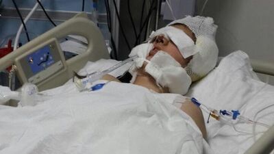 Burun ameliyatı olan genç kız bir daha uyanamadı!