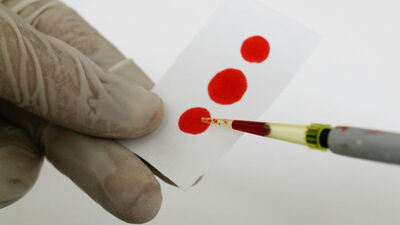 Cep telefonu kan tahlili yapabilecek!