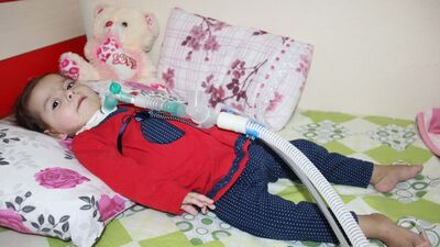 SMA hastası minik bebek yardım bekliyor