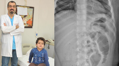 Türk doktorun başarısı!