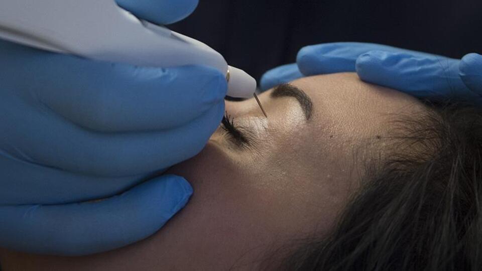 "Göz kapağı düşüklüğü baş ağrısı sebebi olabilir"