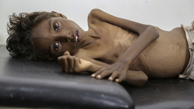 Utanç tablosu! Tam 20 milyon insan...