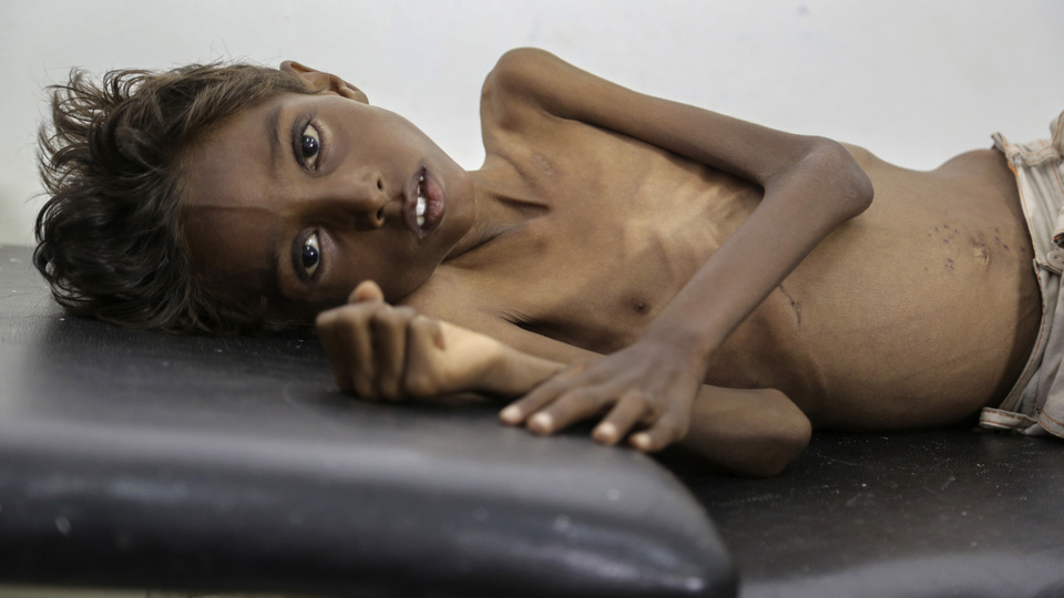 Utanç tablosu! Tam 20 milyon insan...