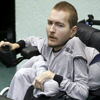 "Kafa nakli çok ızdıraplı olabilir"