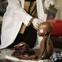 2. Dünya Savaşı'ndan beri en büyük insani kriz!