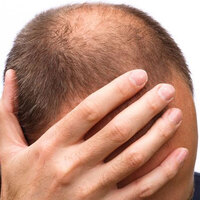 Kel erkeklere kötü haber! İktidarsızlık yapıyor...