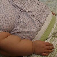 Obezite kanser riskini artırıyor!