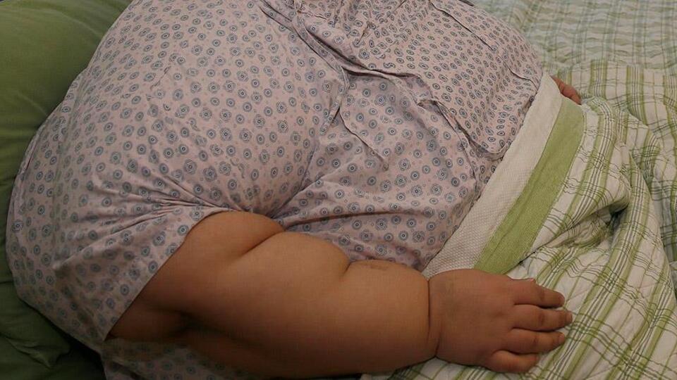 Obezite kanser riskini artırıyor!