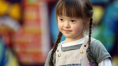 Down sendromunun belirtileri!