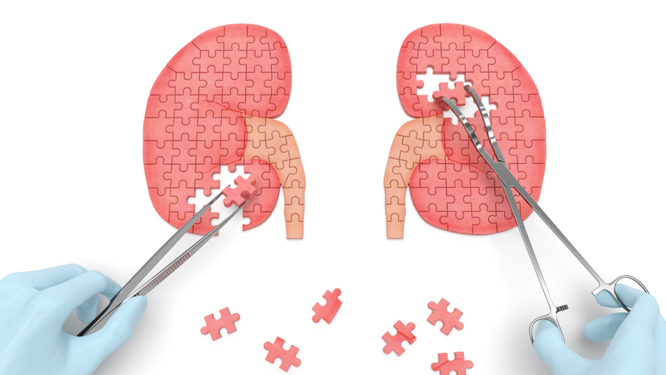 Böbrek kanserlerinin yüzde 50'sine yol açan bu üçlüye dikkat!