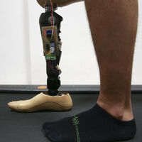 Akıllı diz protezinde Türk imzası!