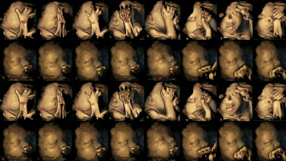 Bu görüntüler şok etti! Anne rahmindeki bebekler sigaraya böyle tepki verdi!