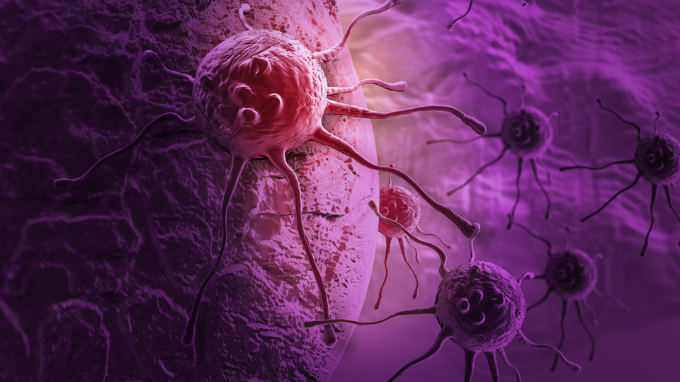 Kanser hastalarına tüyolar! Doğru beslenme ve spor şart!