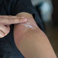 Uyuz hastalığında olağanın dışında artış!