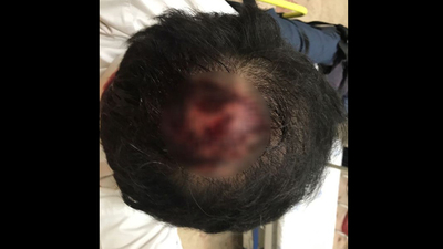 İzmirli işadamına saldırı! Kanlar içinde kaldı