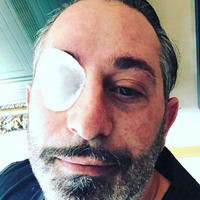 Cem Yılmaz'ın gözüne ne oldu?