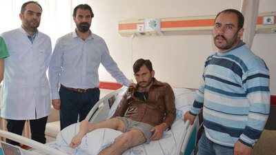 Bacağı tamamen kesilip 180 derece ters dikildi!