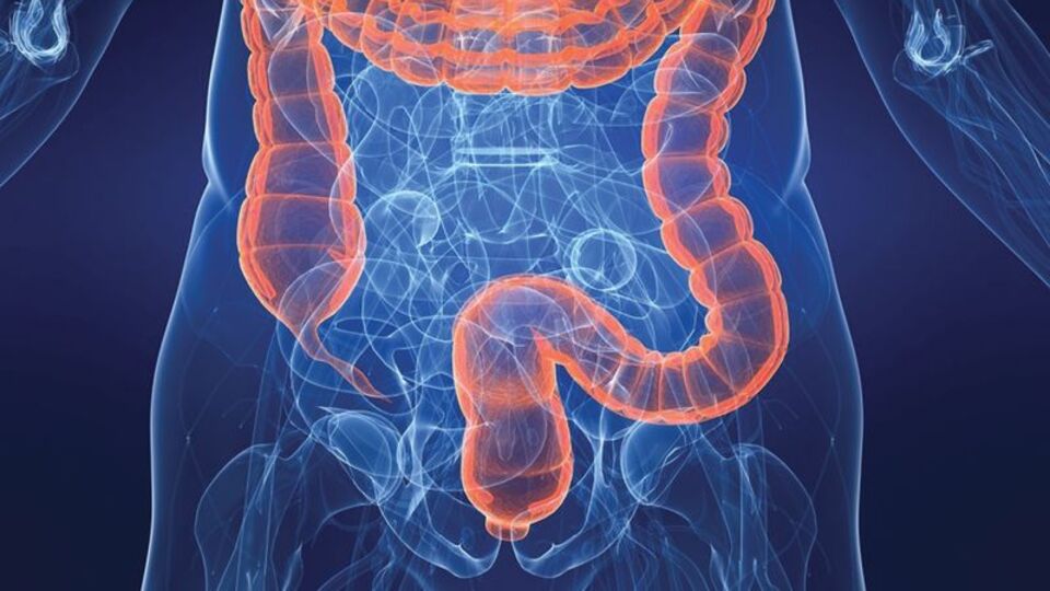 Kolon kanseri dev maketle tanıtıldı