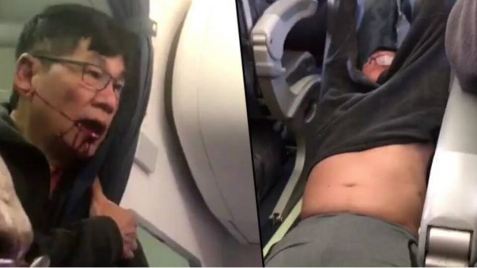 Parayı aldı, United Airlines'ı affetti