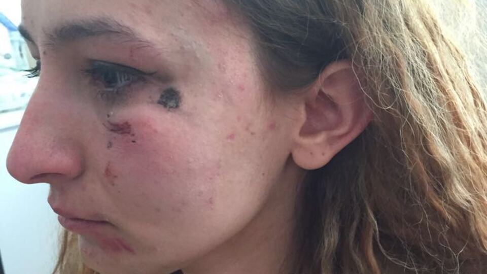 Başkanın yanında kadın polisi darp etti