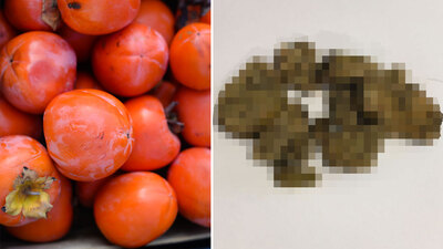 Her gün yediği yiyecek midesinde bu hale geldi!