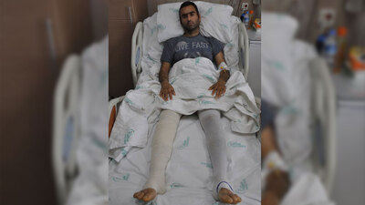 Kalçası puzzle gibi dağıldı! Belden aşağısını hissetmiyordu ama...