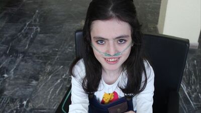 Yürümek, gülmek ve ağlamak onun için işkence!