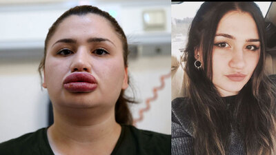 Silikon faciasında gelişme! Estetiği yapan kuaförden yanıt...