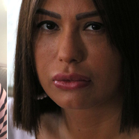 Silikon faciasında yeni perde! Şimdi de evli çift...