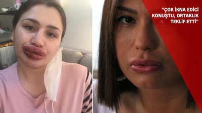 Silikon faciasında yeni perde! Şimdi de evli çift...