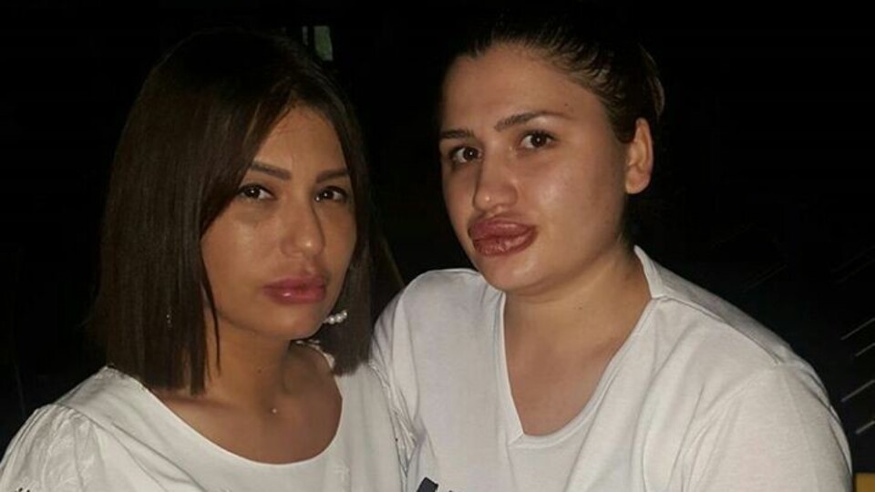 Bakanlıktan 'dudak dolgusu' skandalıyla ilgili açıklama