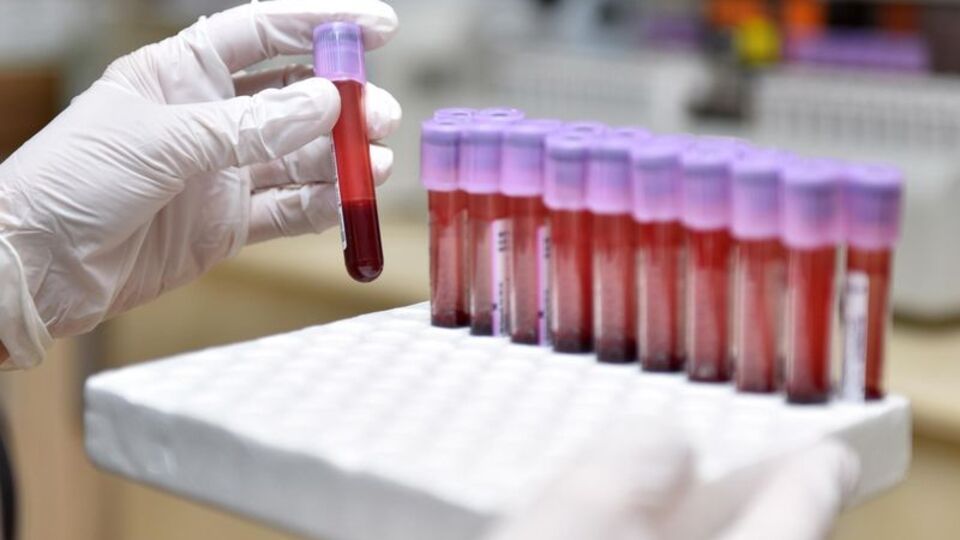 Anne adayları talasemi testini ihmal etmemeli!