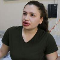 Silikon mağduru Merve Hemşire'den haber var!