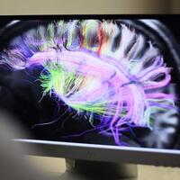 Deliryumun nedeni bulundu!